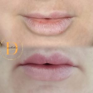 WhatsApp Image 2024 02 20 at 18.59.46 ed5ca377 1