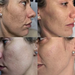 PRP Results prp warrington