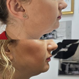 lemon bottle warrington