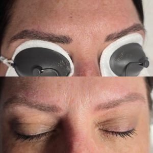 eyebrow tattoo removal Warrington