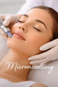 microneedling warrington