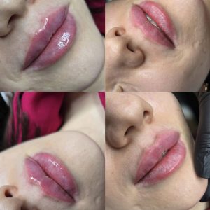 Screenshot 20260315 212148 Instagram